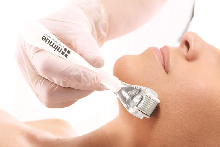 Microneedling 6x pakett koos mesorolleriga